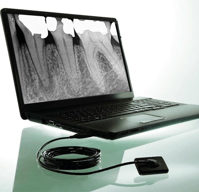 Imaging intraorale Studio Dentistico Smart Dental Tivoli Campolimpido