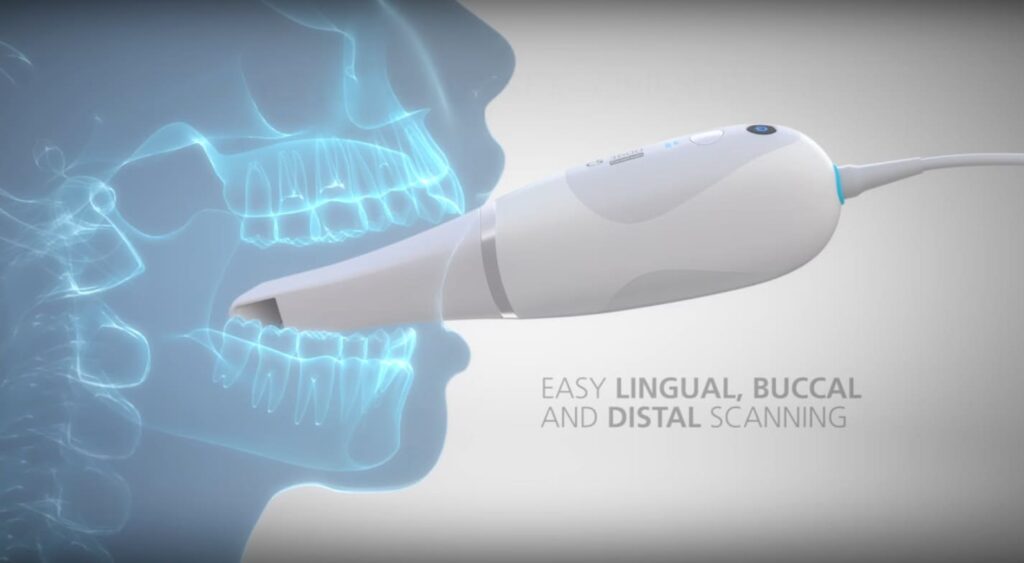 Scanner Intraorale 01 Studio Dentistico Smart Dental Tivoli Campolimpido